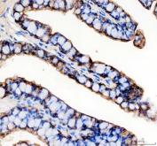 Zebrafish EpCAM Antibody Esophagus IHC. Immunohistochemistry staining of paraffin-embedded zebrafish esophagus tissue using Zebrafish EpCAM Antibody / CD326 Antibody demonstrates strong membranous HRP-DAB brown staining along the epithelial cell lining of the esophageal mucosa. The staining pattern is consistent with expression of Epithelial Cell Adhesion Molecule (EPCAM/CD326), a transmembrane glycoprotein that mediates epithelial cell-cell adhesion and contributes to maintenance of tissue architecture and epithelial integrity. Prominent localization at epithelial cell borders is characteristic of EpCAM expression and highlights its role in regulating cellular interactions within organized epithelial tissues. The observed staining supports the use of EPCAM as a marker for studies of epithelial differentiation, tissue organization, developmental biology, and regenerative processes in zebrafish. Heat-mediated antigen retrieval was performed in EDTA buffer prior to staining.