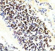 Zebrafish HBBE3 Antibody Erythrocyte IHC. Immunohistochemistry analysis of HBBE3 using Zebrafish HBBE3 Antibody / Embryonic Hemoglobin Beta Antibody demonstrates strong cytoplasmic HRP-DAB brown staining within erythrocyte populations. The staining pattern is consistent with expression of Hemoglobin Beta Embryonic-3 (HBBE3), a beta-globin subunit involved in embryonic hemoglobin formation and oxygen transport during early zebrafish development. Robust staining of nucleated erythroid cells highlights the role of HBBE3 in primitive erythropoiesis and developing blood cell populations. The observed immunoreactivity supports the use of HBBE3 as a marker for embryonic erythrocytes, hematopoietic development, and studies of globin gene expression in zebrafish models. Heat-mediated antigen retrieval was performed in EDTA buffer prior to staining.
