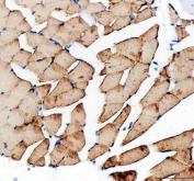 Zebrafish Myostatin Antibody Heart IHC. Immunohistochemistry analysis of MSTNA using Zebrafish Myostatin Antibody / MSTNA Antibody demonstrates widespread cytoplasmic HRP-DAB brown staining throughout zebrafish cardiac muscle fibers. The staining pattern is consistent with expression of Myostatin A (MSTNA), a member of the TGF-beta superfamily that functions as a key regulator of muscle growth, differentiation, and tissue homeostasis. Robust immunoreactivity within striated cardiomyocytes supports the role of MSTNA-associated signaling pathways in muscle development and maintenance. The observed staining demonstrates the utility of this antibody for studies of cardiac muscle biology, myogenesis, developmental regulation, growth control, and muscle-related signaling mechanisms in zebrafish models. Heat-mediated antigen retrieval was performed in EDTA buffer prior to staining.
