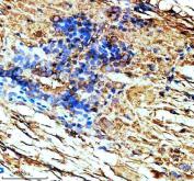 Zebrafish TUBA1A Antibody Spinal Cord IHC. Immunohistochemical staining of paraffin-embedded zebrafish spinal cord tissue using Zebrafish TUBA1A Antibody / Alpha Tubulin Antibody demonstrates distinct cytoplasmic HRP-DAB brown staining within spinal cord cellular populations and surrounding neural structures. The staining pattern is consistent with expression of Alpha Tubulin (TUBA1A), a highly conserved microtubule-associated protein required for cytoskeletal organization, neuronal differentiation, axonal growth, and intracellular transport. TUBA1A immunoreactivity highlights neural tissue architecture and cellular organization within the developing zebrafish spinal cord. Heat-mediated antigen retrieval was performed in EDTA buffer. Sections were blocked with 10% goat serum and incubated overnight at 4Â°C with 2 Âµg/ml primary antibody, followed by peroxidase-conjugated goat anti-rabbit IgG secondary antibody for 30 minutes at 37Â°C. Signal was visualized using DAB chromogen.