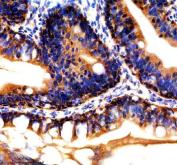 Zebrafish RPL8 Antibody Colon IHC. Immunohistochemical staining of paraffin-embedded zebrafish colon tissue using Zebrafish RPL8 Antibody / Ribosomal Protein L8 Antibody demonstrates prominent cytoplasmic HRP-DAB brown staining within intestinal epithelial cell populations lining the colonic mucosa. The staining pattern is consistent with expression of RPL8, a structural component of the 60S large ribosomal subunit that supports protein synthesis and ribosome function. Strong cytoplasmic localization reflects the abundance of translational machinery within metabolically active epithelial cells, highlighting the essential role of RPL8 in cellular growth, protein production, and maintenance of intestinal tissue homeostasis. Heat-mediated antigen retrieval was performed in EDTA buffer. Sections were blocked with 10% goat serum and incubated overnight at 4Â°C with 2 Âµg/ml primary antibody, followed by peroxidase-conjugated goat anti-rabbit IgG for 30 minutes at 37Â°C. DAB was used as the chromogenic substrate.