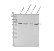 Zebrafish LPL Antibody Embryo and Adult Tissue WB. Western blot analysis of zebrafish head tissue lysate (lane 1), whole female zebrafish tissue lysate (lane 2), whole male zebrafish tissue lysate (lane 3), and zebrafish embryo tissue lysate (lane 4) using Zebrafish LPL Antibody / Lipoprotein Lipase Antibody demonstrates distinct bands at approximately 60 kDa, consistent with the expected molecular weight of Lipoprotein Lipase (LPLA/LPL). Lipoprotein Lipase is a key enzyme involved in triglyceride hydrolysis, fatty acid mobilization, and lipid utilization. By releasing free fatty acids from circulating lipoproteins, LPL supports energy production, tissue growth, and metabolic homeostasis. Detection of LPL in both embryonic and adult zebrafish tissues is consistent with its essential role in lipid metabolism and nutrient utilization throughout development and normal physiologic function. Electrophoresis was performed using a 10% SDS-PAGE gel under reducing conditions with 30 Âµg of protein loaded per lane. Signal was visualized using HRP-conjugated secondary antibody and ECL detection.