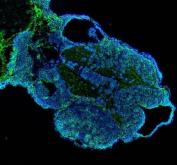 Zebrafish DUSP6 Antibody Embryo IF. Immunofluorescent staining of paraffin-embedded zebrafish embryo tissue using Zebrafish DUSP6 Antibody / Dual Specificity Phosphatase 6 Antibody demonstrates widespread green fluorescence within developing embryonic structures. The staining pattern is consistent with expression of DUSP6, a dual-specificity phosphatase that functions as a key negative regulator of ERK/MAPK signaling pathways. DUSP6 plays an important role in controlling growth factor-mediated signaling responses during embryogenesis, helping regulate cellular differentiation, tissue patterning, and organ development. The observed expression is consistent with the established involvement of DUSP6 in developmental signaling networks and feedback regulation of MAPK pathway activity. Nuclei are counterstained with DAPI (blue). Heat-mediated antigen retrieval was performed in EDTA buffer, and sections were incubated with 5 Âµg/ml primary antibody overnight at 4Â°C followed by DyLight-488 conjugated goat anti-rabbit IgG secondary antibody.