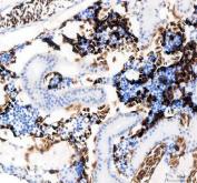 Zebrafish SLC4A1 Antibody Kidney IHC. Immunohistochemical staining of paraffin-embedded zebrafish kidney tissue using Zebrafish SLC4A1 Antibody / SLC4A1A Antibody demonstrates strong HRP-DAB brown staining within erythrocyte-rich cellular populations distributed throughout the renal hematopoietic compartment. The staining pattern is consistent with expression of SLC4A1A, the zebrafish ortholog of human SLC4A1 (Band 3/AE1), a chloride/bicarbonate exchanger that plays an essential role in erythrocyte membrane function, carbon dioxide transport, and acid-base regulation. SLC4A1A is highly associated with erythroid cells and contributes to maintenance of red blood cell membrane integrity and physiologic ion transport. The prominent staining observed within blood cell-rich regions of the zebrafish kidney is consistent with the role of the teleost kidney as a major hematopoietic organ involved in erythropoiesis and blood cell maintenance. Heat-mediated antigen retrieval was performed in EDTA buffer prior to overnight primary antibody incubation and HRP-DAB visualization.