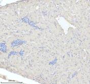 Zebrafish MYL7 Antibody Cardiac Muscle IHC. Immunohistochemical staining of paraffin-embedded zebrafish heart tissue using Zebrafish MYL7 Antibody / Myosin Light Chain 7 Antibody demonstrates low-level cytoplasmic HRP-DAB brown staining within cardiac muscle tissue. MYL7 is a myosin light chain family member that functions within the cardiac contractile apparatus and contributes to regulation of actomyosin interactions, sarcomere organization, and myocardial contraction. In zebrafish, MYL7 is widely used as a marker of cardiomyocyte differentiation and heart development due to its association with developing and mature cardiac muscle cells. The observed staining pattern is consistent with expression of a contractile protein involved in cardiac muscle structure and function. Heat-mediated antigen retrieval was performed in EDTA buffer prior to overnight primary antibody incubation and HRP-DAB visualization.