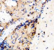 Zebrafish TBX1 Antibody Brain IHC. Immunohistochemical staining of paraffin-embedded zebrafish brain tissue using Zebrafish TBX1 Antibody / T-Box Transcription Factor TBX1 Antibody demonstrates HRP-DAB brown staining within neural tissue and brain-associated cellular populations. TBX1 is a T-box family transcription factor that regulates developmental gene expression programs involved in embryonic patterning, tissue specification, and organogenesis. During vertebrate development, TBX1 participates in genetic networks that coordinate formation of multiple organ systems and contributes to cellular differentiation and tissue morphogenesis. The observed staining pattern is consistent with expression of a developmental transcription factor associated with neural development and embryonic tissue organization. Heat-mediated antigen retrieval was performed in EDTA buffer prior to overnight primary antibody incubation and HRP-DAB visualization.