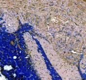 Zebrafish PIWIL1 Antibody IHC. Immunohistochemistry staining of paraffin-embedded zebrafish brain tissue using Zebrafish PIWIL1 Antibody / Piwi-like Protein 1 Antibody demonstrates cytoplasmic and perinuclear HRP-DAB brown staining within discrete cellular populations. The staining pattern is consistent with expression of PIWIL1 (Ziwi), a germline-associated PIWI family protein involved in piRNA-mediated gene silencing, transposon suppression, genome stability, and stem cell maintenance. PIWIL1 is a key regulator of germ cell development and reproductive biology and serves as an important marker for studies of germline specification and developmental genetics in zebrafish. HIER was performed using EDTA buffer. Tissue sections were blocked with 10% goat serum and incubated with primary antibody at 2 ug/ml overnight at 4Â°C prior to detection with HRP-conjugated secondary antibody and DAB chromogen.