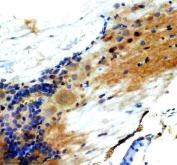 Zebrafish LHX3 Antibody Spinal Cord IHC. Immunohistochemistry staining of paraffin-embedded zebrafish spinal cord tissue using Zebrafish LHX3 Antibody / LIM Homeobox Protein 3 Antibody demonstrates nuclear and cytoplasmic HRP-DAB brown staining within neuronal cell populations. The staining pattern is consistent with expression of LHX3, a LIM-homeodomain transcription factor that plays essential roles in motor neuron specification, spinal cord development, neuronal differentiation, and embryonic patterning. LHX3 is a key regulator of developmental gene expression programs and is widely studied as a marker of developing neural tissues and vertebrate neurogenesis. HIER was performed using EDTA buffer. Tissue sections were blocked with 10% goat serum and incubated with primary antibody at 2 ug/ml overnight at 4Â°C prior to detection with HRP-conjugated secondary antibody and DAB chromogen.