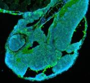 Zebrafish HSP90AA1 Antibody IF. Immunofluorescent staining of paraffin-embedded zebrafish embryo tissue using Zebrafish HSP90AA1 Antibody / Heat Shock Protein 90 Alpha Antibody demonstrates widespread green fluorescence throughout developing embryonic tissues. The staining pattern is consistent with expression of HSP90A, a highly conserved molecular chaperone orthologous to human HSP90AA1 (heat shock protein 90 alpha family class A member 1). HSP90A functions in protein folding, stabilization of signaling proteins, cellular stress responses, and maintenance of proteostasis, making it essential for normal embryonic development and tissue homeostasis. HIER was performed in pH 8.0 EDTA buffer prior to staining. Tissue sections were blocked with 10% goat serum and incubated with primary antibody at 5 ug/ml overnight at 4Â°C. DyLightÂ®488-conjugated goat anti-rabbit IgG was used as the secondary antibody (green), and nuclei were counterstained with DAPI (blue). The image supports detection of HSP90A expression in developing zebrafish embryonic tissues by immunofluorescence.
