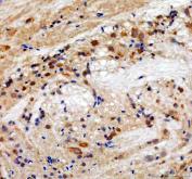 Zebrafish HSP90AA1 Antibody Brain IHC. Immunohistochemistry staining of paraffin-embedded zebrafish brain tissue using Zebrafish HSP90AA1 Antibody / Heat Shock Protein 90 Alpha Antibody demonstrates widespread cytoplasmic HRP-DAB brown staining within neural tissue-associated cellular populations. The staining pattern is consistent with expression of HSP90A, a highly conserved molecular chaperone orthologous to human HSP90AA1 (heat shock protein 90 alpha family class A member 1). HSP90A functions in protein folding, stabilization of signaling proteins, cellular stress responses, and maintenance of proteostasis, making it an important regulator of neuronal homeostasis and developmental signaling pathways. HIER was performed in pH 8.0 EDTA buffer. Tissue sections were blocked with 10% goat serum and incubated with primary antibody at 2 ug/ml overnight at 4Â°C prior to detection with HRP-conjugated secondary antibody and DAB chromogen.