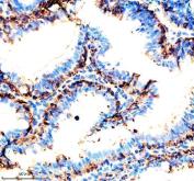 Zebrafish CDH17 Antibody Colon IHC. Immunohistochemistry staining of paraffin-embedded zebrafish colon tissue using Zebrafish CDH17 Antibody / Cadherin-17 Antibody demonstrates strong membranous and cytoplasmic HRP-DAB brown staining within intestinal epithelial cells lining glandular and luminal structures. The staining pattern is consistent with expression of CDH17 (Cadherin-17), a calcium-dependent cell adhesion molecule involved in epithelial organization, maintenance of tissue integrity, and gastrointestinal tract development. CDH17 is widely recognized as a marker of intestinal epithelial differentiation and digestive system maturation in zebrafish. HIER was performed using EDTA buffer. Tissue sections were blocked with 10% goat serum and incubated with primary antibody at 2 ug/ml overnight at 4C prior to detection with peroxidase-conjugated goat anti-rabbit IgG and DAB chromogen.