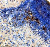 Zebrafish SSTR2 Antibody Brain IHC. Immunohistochemistry staining of paraffin-embedded zebrafish brain tissue using Zebrafish SSTR2 Antibody / Somatostatin Receptor 2 Antibody demonstrates localized HRP-DAB brown staining within discrete neural cell populations. The staining pattern is consistent with expression of SSTR2, a G protein-coupled receptor that mediates the biological effects of somatostatin and regulates neuroendocrine signaling, neurotransmission, and neuronal activity. SSTR2 plays important roles in nervous system development, cellular communication, and modulation of signaling pathways that influence neuronal function and tissue homeostasis. HIER was performed using EDTA buffer prior to staining. Tissue sections were blocked with 10% goat serum and incubated with primary antibody at 2 ug/ml overnight at 4C before detection with peroxidase-conjugated goat anti-rabbit IgG and DAB chromogen.