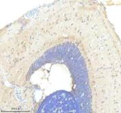 Zebrafish FOXC1 Antibody Brain IHC. Immunohistochemistry staining of paraffin-embedded zebrafish brain tissue using Zebrafish FOXC1 Antibody / Forkhead Box C1A Antibody demonstrates nuclear and perinuclear HRP-DAB brown staining within discrete neural cell populations. The staining pattern is consistent with expression of FOXC1A, a forkhead box transcription factor that regulates gene expression programs involved in embryonic development, neural crest biology, tissue patterning, and morphogenesis. FOXC1A plays important roles in vertebrate nervous system development and contributes to transcriptional networks that govern cellular differentiation and tissue organization. HIER was performed using EDTA buffer prior to staining. Tissue sections were blocked with 10% goat serum and incubated with primary antibody at 2 ug/ml overnight at 4C before detection with peroxidase-conjugated goat anti-rabbit IgG and DAB chromogen.