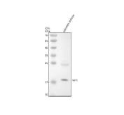 Zebrafish VENTX Antibody Embryo WB. Western blot analysis of zebrafish embryo lysate using Zebrafish VENTX Antibody / Vega2 Antibody demonstrates a distinct immunoreactive band at approximately 19 kDa, consistent with expression of Vega2 (vent), a zebrafish homeobox transcription factor and ortholog of human VENTX. Vega2 functions as a key regulator of dorsoventral patterning, mesoderm specification, and embryonic development through transcriptional control of genes involved in early developmental signaling pathways. The observed band corresponds closely with the expected molecular weight of the target protein and supports specific detection of endogenous Vega2 in developing zebrafish embryonic tissue. Primary antibody was used at 0.5 ug/ml. Predicted and observed molecular weight: approximately 19 kDa.