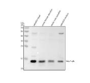 Zebrafish FABP7 Antibody WB. Western blot analysis of zebrafish head, whole female, whole male, and embryo tissue lysates using Zebrafish FABP7 Antibody / Brain Lipid Binding Protein Antibody demonstrates a distinct immunoreactive band at approximately 14-15 kDa, consistent with expression of FABP7A/B (Brain Lipid Binding Protein). FABP7 is a member of the fatty acid-binding protein family that functions in intracellular lipid transport, fatty acid metabolism, and regulation of neural developmental pathways. The protein is widely studied as a marker of neural progenitor populations and developing nervous system tissues. The observed banding pattern across multiple zebrafish tissues supports endogenous expression of FABP7-related proteins and is consistent with the expected molecular weight of the target. Primary antibody was used at 0.5 ug/ml. Predicted and observed molecular weight: approximately 14-15 kDa.
