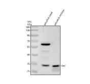 Zebrafish DAZL Antibody Head and Embryo WB. Western blot analysis of zebrafish head (lane 1) and embryo (lane 2) tissue lysates using Zebrafish DAZL Antibody / Germline Development Protein Antibody demonstrates a distinct immunoreactive band at approximately 30-35 kDa, consistent with expression of DAZL. DAZL is a conserved RNA-binding protein that regulates germline specification, germ cell survival, and reproductive development through control of mRNA translation and post-transcriptional gene expression. The strong signal observed in embryonic tissue is consistent with the established role of DAZL during early germline development and primordial germ cell formation. Although the predicted molecular weight of DAZL is approximately 25 kDa, the protein is observed at approximately 30-35 kDa, a migration pattern that has been reported for DAZL family proteins and may reflect phosphorylation and anomalous electrophoretic mobility of this RNA-binding protein. Primary antibody was used at 0.5 ug/ml. Predicted molecular weight: approximately 25 kDa. Observed molecular weight: approximately 30-35 kDa.
