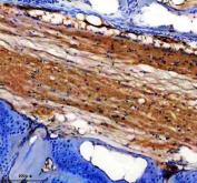 Zebrafish DTNB Antibody Spinal Cord IHC. Immunohistochemical analysis of paraffin-embedded zebrafish spinal cord tissue using Zebrafish DTNB Antibody / Dystrobrevin Alpha Antibody demonstrates strong cytoplasmic and fiber-associated HRP-DAB brown staining within elongated neural and supporting tissue structures. The staining pattern is consistent with expression of Dystrobrevin Alpha (DTNBA), a component of the dystrophin-associated protein complex involved in cytoskeletal organization, membrane stability, and neuromuscular signaling. Positive immunoreactivity highlights structures associated with spinal cord architecture and neuronal connectivity, supporting the role of DTNBA in nervous system development and maintenance. Heat-induced antigen retrieval was performed in EDTA buffer. Tissue sections were blocked with 10% goat serum and incubated with DTNBA antibody (2 ug/ml) overnight at 4Â°C, followed by Peroxidase Conjugated Goat Anti-rabbit IgG and DAB chromogen detection.