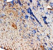 Zebrafish HMGCS1 Antibody Brain IHC. Immunohistochemical analysis of paraffin-embedded zebrafish brain tissue using Zebrafish HMGCS1 Antibody / HMG-CoA Synthase 1 Antibody demonstrates widespread cytoplasmic HRP-DAB brown staining throughout neural tissue. The staining pattern is consistent with expression of HMGCS1, a key enzyme of the mevalonate pathway that catalyzes an early step in cholesterol and isoprenoid biosynthesis. Positive immunoreactivity within the brain is consistent with the essential requirement for cholesterol metabolism and membrane synthesis in neuronal development, cellular signaling, and maintenance of nervous system function. Heat-induced antigen retrieval was performed in EDTA buffer. Tissue sections were blocked with 10% goat serum and incubated with HMGCS1 antibody (2 ug/ml) overnight at 4Â°C, followed by Peroxidase Conjugated Goat Anti-rabbit IgG and DAB chromogen detection.