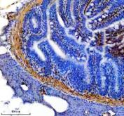 Zebrafish TPM1 Antibody Colon IHC. Immunohistochemical analysis of paraffin-embedded zebrafish colon tissue using Zebrafish TPM1 Antibody / Tropomyosin Alpha-1 Chain Antibody demonstrates strong HRP-DAB brown staining within the smooth muscle layers surrounding the intestinal wall. The staining pattern is consistent with expression of TPM1, an actin-binding protein that stabilizes actin filaments and regulates actin-myosin interactions required for muscle contraction. Positive immunoreactivity highlights the contractile apparatus of gastrointestinal smooth muscle and supports the essential role of TPM1 in muscle structure, force generation, and maintenance of tissue integrity. Heat-induced antigen retrieval was performed in EDTA buffer. Tissue sections were blocked with 10% goat serum and incubated with TPM1 antibody (2 ug/ml) overnight at 4Â°C, followed by Peroxidase Conjugated Goat Anti-rabbit IgG and DAB chromogen detection.