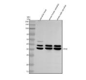 Zebrafish TPM1 Antibody Multi-Tissue WB. Western blot analysis of 1) zebrafish head tissue lysate, 2) whole female zebrafish lysate, and 3) whole male zebrafish lysate using Zebrafish TPM1 Antibody / Tropomyosin Alpha-1 Chain Antibody. Prominent immunoreactive bands are detected at approximately 36-40 kDa in all samples, consistent with expression of TPM1. Tropomyosin proteins are known to exist as multiple isoforms generated through alternative splicing and differential promoter usage, resulting in closely migrating bands that are commonly observed by western blot analysis. TPM1 functions as a key actin-binding protein that stabilizes actin filaments and regulates actin-myosin interactions required for muscle contraction, sarcomere organization, and cytoskeletal integrity. The observed expression pattern supports the widespread role of TPM1 in muscle structure and contractile function throughout zebrafish tissues. Electrophoresis was performed on a 10% SDS-PAGE gel under reducing conditions. Predicted molecular weight: ~32 kDa. Observed molecular weights: ~36-40 kDa.