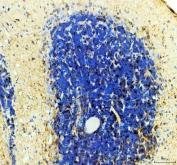 Zebrafish DIO3 Antibody Brain IHC. Immunohistochemical analysis of paraffin-embedded zebrafish brain tissue using Zebrafish DIO3 Antibody / Iodothyronine Deiodinase 3 Antibody demonstrates localized HRP-DAB brown staining within neural tissue surrounding densely cellular brain regions. The staining pattern is consistent with expression of DIO3A, a thyroid hormone-inactivating enzyme that regulates local availability of triiodothyronine (T3) and thyroxine (T4) during vertebrate development. DIO3A-mediated control of thyroid hormone signaling is essential for proper neurodevelopment, neuronal differentiation, and maintenance of endocrine homeostasis. Positive immunoreactivity within brain tissue supports the role of DIO3A in regulating tissue-specific thyroid hormone activity and developmental signaling pathways in the nervous system. Heat-induced antigen retrieval was performed in EDTA buffer. Tissue sections were blocked with 10% goat serum and incubated with DIO3A antibody (2 ug/ml) overnight at 4Â°C, followed by Peroxidase Conjugated Goat Anti-rabbit IgG and DAB chromogen detection.