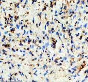 Zebrafish DMPK Antibody Heart IHC. Immunohistochemical analysis of paraffin-embedded zebrafish heart tissue using Zebrafish DMPK Antibody / Myotonic Dystrophy Protein Kinase Antibody demonstrates cytoplasmic staining within cardiomyocytes and associated cardiac tissue structures. DMPK is a serine/threonine protein kinase involved in muscle function, cytoskeletal regulation, and intracellular signaling pathways that contribute to normal cardiac and skeletal muscle physiology. The observed staining pattern is consistent with endogenous DMPK expression and supports the utility of this antibody for immunohistochemical detection of DMPK in zebrafish tissues. Heat-mediated antigen retrieval was performed in EDTA buffer. The tissue section was blocked with 10% goat serum and incubated overnight at 4Â°C with rabbit anti-DMPK antibody (2 ug/ml). Detection was performed using a peroxidase-conjugated goat anti-rabbit IgG secondary antibody followed by DAB chromogen development.