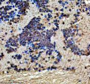 Zebrafish DMPK Antibody Brain IHC. Immunohistochemical analysis of paraffin-embedded zebrafish brain tissue using Zebrafish DMPK Antibody / Myotonic Dystrophy Protein Kinase Antibody demonstrates cytoplasmic staining within neuronal and neuropil-rich regions. DMPK is a serine/threonine protein kinase involved in cytoskeletal organization, intracellular signaling, and the regulation of cellular architecture in muscle and neural tissues. The observed staining pattern is consistent with endogenous DMPK expression and supports the utility of this antibody for immunohistochemical detection of DMPK in zebrafish tissues. Heat-mediated antigen retrieval was performed in EDTA buffer. The tissue section was blocked with 10% goat serum and incubated overnight at 4Â°C with rabbit anti-DMPK antibody (2 ug/ml). Detection was performed using a peroxidase-conjugated goat anti-rabbit IgG secondary antibody followed by DAB chromogen development.