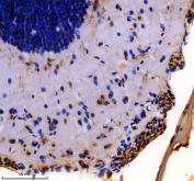 Zebrafish VHL Antibody Brain IHC. Immunohistochemistry staining of paraffin-embedded zebrafish brain tissue using VHL antibody demonstrates distinct staining within neural tissue compartments and cells lining peripheral brain structures, consistent with expression of Von Hippel-Lindau protein (VHL). VHL is a key regulator of hypoxia-responsive signaling pathways that controls the stability of hypoxia-inducible factor (HIF) proteins and helps coordinate cellular responses to oxygen availability. The observed staining pattern is consistent with the established role of VHL in oxygen sensing, developmental regulation, and maintenance of cellular homeostasis within vertebrate tissues. Heat-mediated antigen retrieval was performed in EDTA buffer. Tissue sections were stained with 2 ug/ml primary antibody and visualized using DAB chromogen.