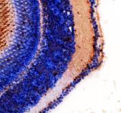 Zebrafish FOXD1 Antibody Eye IHC. Immunohistochemistry staining of paraffin-embedded zebrafish eye tissue using FOXD1 antibody demonstrates distinct staining within retinal-associated cellular layers and adjacent ocular structures, consistent with expression of Forkhead Box Protein D1 (FOXD1). FOXD1 is a developmental transcription factor that regulates gene expression programs involved in tissue patterning, cellular differentiation, and organogenesis. The observed staining pattern within the developing eye is consistent with the established role of FOXD1 in regional specification and developmental regulation of vertebrate sensory tissues. Heat-mediated antigen retrieval was performed in EDTA buffer. Tissue sections were stained with 2 ug/ml primary antibody and visualized using DAB chromogen.