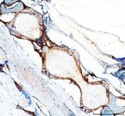 Zebrafish COL10A1 Antibody IHC. Immunohistochemistry analysis of COL10A1A using anti-COL10A1 antibody. COL10A1A was detected in a paraffin-embedded section of zebrafish vertebra tissue. Heat mediated antigen retrieval was performed in EDTA buffer. The tissue section was blocked with 10% goat serum. The tissue section was then incubated with 2 ug/ml rabbit anti-COL10A1A Antibody overnight at 4oC. Peroxidase Conjugated Goat Anti-rabbit IgG was used as secondary antibody and incubated for 30 minutes at 37oC. The tissue section was developed using DAB as the chromogen.
