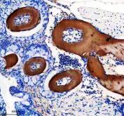 Zebrafish COL10A1 Antibody Tooth IHC. Immunohistochemistry staining of paraffin-embedded zebrafish tooth tissue using COL10A1 antibody demonstrates intense staining within mineralized tooth-associated matrix structures, consistent with expression of Collagen Type X Alpha 1a (COL10A1A). COL10A1A is a structural extracellular matrix protein that contributes to cartilage maturation, matrix organization, and skeletal development. The observed staining pattern within odontogenic and mineralized tissue compartments is consistent with the established role of type X collagen family members in formation and maintenance of specialized extracellular matrix environments associated with skeletal and craniofacial development. Heat-mediated antigen retrieval was performed in EDTA buffer. Tissue sections were stained with 2 ug/ml primary antibody and visualized using DAB chromogen.