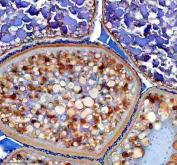 Zebrafish MC4R Antibody Ovary IHC. Immunohistochemistry staining of paraffin-embedded zebrafish ovary tissue using MC4R antibody demonstrates widespread cytoplasmic and membranous staining throughout oocyte-associated cellular compartments, consistent with expression of Melanocortin Receptor 4 (MC4R). MC4R is a G protein-coupled receptor that mediates melanocortin signaling pathways involved in neuroendocrine communication, energy homeostasis, and hormonal regulation. The observed staining pattern within ovarian tissue is consistent with the established role of melanocortin signaling in coordinating endocrine functions and reproductive physiology in vertebrates. Heat-mediated antigen retrieval was performed in EDTA buffer. Tissue sections were stained with 2 ug/ml primary antibody and visualized using DAB chromogen.