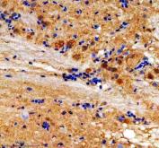 Zebrafish MC4R Antibody Brain IHC. Immunohistochemistry staining of paraffin-embedded zebrafish brain tissue using MC4R antibody demonstrates widespread cytoplasmic and membranous staining within neural cell populations, consistent with expression of Melanocortin Receptor 4 (MC4R). MC4R is a G protein-coupled receptor that mediates melanocortin-dependent neuroendocrine signaling pathways involved in energy homeostasis, feeding regulation, and hormonal communication. The observed staining pattern within brain tissue is consistent with the established role of MC4R in coordinating neuronal and endocrine signaling networks that regulate physiologic homeostasis and adaptive responses in vertebrates. Heat-mediated antigen retrieval was performed in EDTA buffer. Tissue sections were stained with 2 ug/ml primary antibody and visualized using DAB chromogen.