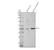 Zebrafish MC4R Antibody WB. Western blot analysis of MC4R using anti-MC4R antibody demonstrates a distinct immunoreactive band at approximately 40 kDa in zebrafish head and whole male tissue lysates, consistent with expression of Melanocortin Receptor 4 (MC4R). MC4R is a G protein-coupled receptor that mediates melanocortin signaling pathways involved in neuroendocrine communication, energy homeostasis, feeding regulation, and hormonal control. The observed expression in neural and whole-body tissues is consistent with the established role of MC4R in coordinating physiologic responses through conserved endocrine and neuronal signaling networks. Western blot was performed using 0.5 ug/ml primary antibody. Predicted molecular weight: ~36 kDa.