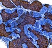 Zebrafish IGF3 Antibody Testis IHC. Immunohistochemistry staining of paraffin-embedded zebrafish testis tissue using IGF3 antibody demonstrates widespread cytoplasmic staining throughout seminiferous tissue compartments, consistent with expression of Insulin-like Growth Factor 3 (IGF3). IGF3 is a secreted growth factor that belongs to the insulin-like growth factor family and plays important roles in reproductive biology, gonadal development, cellular differentiation, and endocrine signaling. The observed staining pattern within testicular tissue is consistent with the established role of IGF3 in regulating reproductive maturation and growth factor-mediated communication within the vertebrate reproductive system. Heat-mediated antigen retrieval was performed in EDTA buffer. Tissue sections were stained with 2 ug/ml primary antibody and visualized using DAB chromogen.