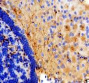 Zebrafish KISS2 Antibody Brain IHC. Immunohistochemistry staining of paraffin-embedded zebrafish brain tissue using KISS2 antibody demonstrates widespread cytoplasmic staining within neuronal cell populations, consistent with expression of Kisspeptin 2 (KISS2). KISS2 is a neuroendocrine signaling peptide that participates in reproductive regulation, hormonal communication, and coordination of endocrine pathways. The observed staining pattern within neural tissue is consistent with the established role of kisspeptin family members in integrating neuronal and endocrine signaling networks that regulate reproductive physiology, developmental timing, and vertebrate homeostasis. Heat-mediated antigen retrieval was performed in EDTA buffer. Tissue sections were stained with 2 ug/ml primary antibody and visualized using DAB chromogen.