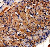 Zebrafish DAPK2A Antibody Heart IHC. Immunohistochemistry staining of paraffin-embedded zebrafish heart tissue using DAPK2A antibody demonstrates widespread cytoplasmic staining throughout cardiomyocyte-rich regions, consistent with expression of Death Associated Protein Kinase 2a (DAPK2A). DAPK2A is a calcium/calmodulin-regulated serine/threonine kinase that participates in signaling pathways governing cellular regulation, stress responses, and programmed cell fate decisions. The observed staining pattern within cardiac tissue is consistent with the role of DAPK family proteins in coordinating intracellular signaling networks that support tissue homeostasis, cellular adaptation, and maintenance of normal physiologic function. Heat-mediated antigen retrieval was performed in EDTA buffer. Tissue sections were stained with 2 ug/ml primary antibody and visualized using DAB chromogen.