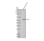 Zebrafish DAPK2A Antibody WB. Western blot analysis of DAPK2A using anti-DAPK2A antibody demonstrates a distinct immunoreactive band at approximately 56 kDa in zebrafish embryo lysate, consistent with the expected molecular weight of Death Associated Protein Kinase 2a (DAPK2A). DAPK2A is a calcium/calmodulin-regulated serine/threonine kinase that participates in intracellular signaling pathways involved in cellular regulation, stress responses, and programmed cell fate decisions. The observed embryonic expression is consistent with the role of DAPK family proteins in coordinating kinase-dependent signaling networks that contribute to vertebrate development, tissue homeostasis, and cellular adaptation. Western blot was performed using 0.5 ug/ml primary antibody. Predicted molecular weight: ~56 kDa.