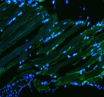 Zebrafish Desmin Antibody by IF in zebrafish muscle. Immunofluorescence staining of FFPE zebrafish muscle tissue using Zebrafish Desmin Antibody at 5 ug/ml. Green fluorescence highlights elongated muscle fibers and filament-associated structures, while DAPI counterstaining identifies nuclei in blue. Heat-induced antigen retrieval was performed in EDTA buffer, pH 8.0, followed by overnight primary antibody incubation at 4oC. Fluoro488-conjugated goat anti-rabbit IgG was used at 1:500. This DES Antibody recognizes a muscle-associated intermediate filament protein involved in maintaining cellular architecture.