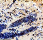 Zebrafish WNT8 Antibody Brain IHC. Immunohistochemistry analysis of zebrafish brain tissue using anti-WNT8A antibody demonstrates distinct cytoplasmic staining within neural cell populations, consistent with expression of WNT8, a secreted signaling ligand that functions as an important regulator of the Wnt signaling pathway. WNT8 plays a critical role in embryonic patterning, axis formation, tissue specification, and developmental signaling during vertebrate development. The observed staining pattern is consistent with the established involvement of Wnt pathway components in neurodevelopmental processes and cellular communication within the nervous system. Heat-mediated antigen retrieval was performed in EDTA buffer. Tissue sections were blocked with 10% goat serum and incubated with 2 ug/ml primary antibody overnight at 4Â°C. Detection was performed using a peroxidase-conjugated goat anti-rabbit IgG secondary antibody followed by DAB chromogen development.