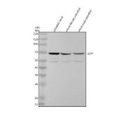Zebrafish LCP1 Antibody WB. Western blot analysis of LCP1 expression was performed using anti-LCP1 antibody. Electrophoresis was carried out on a 10% SDS-PAGE gel under reducing conditions. Lane 1: zebrafish head tissue lysate. Lane 2: whole female zebrafish tissue lysate. Lane 3: whole male zebrafish tissue lysate. LCP1, also known as L-Plastin or Lymphocyte Cytosolic Protein 1, is a calcium-regulated actin-bundling protein that plays essential roles in leukocyte migration, immune cell activation, and cytoskeletal remodeling. A specific immunoreactive band is detected at approximately 70 kDa in all three samples, corresponding to the expected molecular weight of LCP1. Similar expression in head and whole-body lysates is consistent with the broad distribution of LCP1-positive leukocytes and the widespread requirement for actin cytoskeletal regulation in vertebrate tissues. These results support the utility of Zebrafish LCP1 Antibody for studies of hematopoiesis, innate immunity, inflammation, and cell migration.
