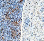 Zebrafish LCP1 Antibody Zebrafish Spleen and Liver IHC. Zebrafish LCP1 Antibody was used for immunohistochemical staining of paraffin-embedded zebrafish spleen (left) and liver (right) tissue sections. Heat-induced epitope retrieval was performed in pH 8 EDTA buffer before incubation with the primary antibody at 2 ug/ml, followed by HRP-conjugated secondary antibody and DAB visualization. Strong immunoreactivity is observed throughout the spleen, while comparatively sparse positive cells are present within the liver, consistent with the enrichment of LCP1 in hematopoietic and immune cell populations. This Zebrafish LCP1 Antibody, an L-Plastin Antibody, is well suited for investigating zebrafish leukocyte distribution, immune cell biology, hematopoiesis, and inflammatory responses.