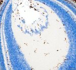 Zebrafish LCP1 Antibody Zebrafish Eye IHC. Zebrafish LCP1 Antibody was used for immunohistochemical staining of paraffin-embedded zebrafish eye tissue. Heat-induced epitope retrieval was performed in pH 8 EDTA buffer before incubation with the primary antibody at 2 ug/ml, followed by HRP-conjugated secondary antibody and DAB visualization. Numerous LCP1-positive cells with ramified morphology are distributed throughout the retinal layers and vitreous region, consistent with resident microglia and other immune cell populations of the eye. This Zebrafish LCP1 Antibody, an L-Plastin Antibody, is well suited for investigating zebrafish retinal immune cells, ocular inflammation, microglial biology, and innate immune responses.
