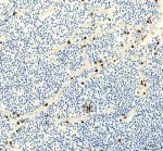 Zebrafish LCP1 Antibody Zebrafish Heart IHC. Zebrafish LCP1 Antibody was used for immunohistochemical staining of paraffin-embedded zebrafish heart tissue. Heat-induced epitope retrieval was performed in pH 8 EDTA buffer before incubation with the primary antibody at 2 ug/ml, followed by HRP-conjugated secondary antibody and DAB visualization. Scattered LCP1-positive cells are observed throughout the cardiac tissue, primarily within the interstitial spaces, consistent with infiltrating or resident leukocytes that express L-Plastin. This Zebrafish LCP1 Antibody, an L-Plastin Antibody, is well suited for investigating zebrafish cardiac immune cell distribution, inflammation, tissue remodeling, and innate immune responses.