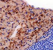 Zebrafish eEF1A Antibody Heart IHC. Immunohistochemistry analysis of EEF1A1A/1B using anti-EEF1A antibody. EEF1A1A/1B was detected in a paraffin-embedded section of zebrafish heart tissue. Heat mediated antigen retrieval was performed in EDTA buffer. The tissue section was blocked with 10% goat serum. The tissue section was then incubated with 2 ug/ml rabbit anti-EEF1A1A/1B Antibody overnight at 4oC. Peroxidase Conjugated Goat Anti-rabbit IgG was used as secondary antibody and incubated for 30 minutes at 37oC. The tissue section was developed using DAB as the chromogen.