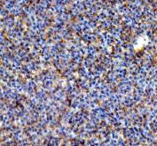 Zebrafish ALDH2 Antibody / ALDH2.1/2.2 Liver IHC. Immunohistochemistry analysis of ALDH2.1,2.2 using anti-ALDH2.1,2.2 antibody. ALDH2.1,2.2 was detected in a paraffin-embedded section of zebrafish liver tissue. Heat mediated antigen retrieval was performed in EDTA buffer. The tissue section was blocked with 10% goat serum. The tissue section was then incubated with 2 ug/ml rabbit anti-ALDH2.1,2.2 Antibody overnight at 4oC. Peroxidase Conjugated Goat Anti-rabbit IgG was used as secondary antibody and incubated for 30 minutes at 37oC. The tissue section was developed using DAB as the chromogen.