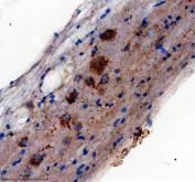Zebrafish DCP2 Antibody Spinal Cord IHC. Immunohistochemical analysis of DCP2 expression was performed using anti-DCP2 antibody in paraffin-embedded zebrafish spinal cord tissue. DCP2, also known as mRNA Decapping Enzyme 2, is the catalytic component of the mRNA decapping complex that initiates 5â²-to-3â² mRNA degradation and regulates post-transcriptional gene expression. Cytoplasmic staining is observed throughout spinal cord cells, consistent with the localization of DCP2 within cytoplasmic processing bodies (P-bodies) where mRNA turnover and RNA quality control occur. The staining pattern supports the essential role of DCP2 in regulating transcript stability during neural development and maintaining cellular RNA homeostasis. These results support the utility of Zebrafish DCP2 Antibody for studies of RNA metabolism, post-transcriptional gene regulation, and vertebrate development. Heat-mediated antigen retrieval was performed in EDTA buffer, followed by incubation with DCP2 antibody at 2 ug/ml overnight at 4Â°C. Detection was achieved using a peroxidase-conjugated goat anti-rabbit IgG secondary antibody and DAB chromogen.