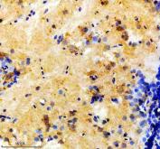 Zebrafish DCP2 Antibody Brain IHC. Immunohistochemical analysis of DCP2 expression was performed using anti-DCP2 antibody in paraffin-embedded zebrafish brain tissue. DCP2, also known as mRNA Decapping Enzyme 2, is the catalytic component of the mRNA decapping complex that initiates 5â²-to-3â² mRNA degradation and regulates post-transcriptional gene expression. Moderate cytoplasmic staining is observed in neuronal cells throughout the brain, consistent with the localization of DCP2 within cytoplasmic processing bodies (P-bodies) that coordinate mRNA turnover and RNA quality control. The widespread neuronal staining pattern supports the essential role of DCP2 in regulating transcript stability, neural development, and maintenance of cellular RNA homeostasis. These results support the utility of Zebrafish DCP2 Antibody for studies of RNA metabolism, post-transcriptional gene regulation, and vertebrate nervous system development. Heat-mediated antigen retrieval was performed in EDTA buffer, followed by incubation with DCP2 antibody at 2 ug/ml overnight at 4Â°C. Detection was achieved using a peroxidase-conjugated goat anti-rabbit IgG secondary antibody and DAB chromogen.