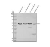 Zebrafish DCP2 Antibody WB. Western blot analysis of DCP2 expression was performed using anti-DCP2 antibody. Electrophoresis was carried out on a 10% SDS-PAGE gel under reducing conditions. Lane 1: zebrafish head tissue lysate. Lane 2: whole female zebrafish tissue lysate. Lane 3: whole male zebrafish tissue lysate. Lane 4: zebrafish embryo tissue lysate. DCP2, also known as mRNA Decapping Enzyme 2, is the catalytic component of the mRNA decapping complex that removes the 5â² cap from messenger RNA to initiate transcript degradation and regulate post-transcriptional gene expression. A specific immunoreactive band is detected at approximately 48 kDa in all four samples, close to the expected molecular weight of DCP2 (~44 kDa). Similar expression in head, whole-body, and embryo lysates is consistent with the fundamental role of DCP2 in mRNA turnover, RNA quality control, and developmental gene regulation. These results support the utility of Zebrafish DCP2 Antibody for studies of RNA metabolism, post-transcriptional gene regulation, and vertebrate development.