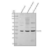 Zebrafish HOXA10 Antibody WB. Western blot analysis of HOXA10 expression was performed using anti-HOXA10B antibody. Electrophoresis was carried out on a 10% SDS-PAGE gel under reducing conditions. Lane 1: zebrafish head tissue lysate. Lane 2: whole female zebrafish tissue lysate. Lane 3: whole male zebrafish tissue lysate. HOXA10B is a zebrafish ortholog of the mammalian HOXA10 homeobox transcription factor that regulates embryonic patterning, tissue specification, and anterior-posterior body axis development. A specific immunoreactive band is detected at approximately 37 kDa in all three samples, corresponding to the expected molecular weight of HOXA10B. The consistent expression across head and whole-body lysates supports the widespread developmental role of HOXA10B in regulating transcriptional programs required for vertebrate morphogenesis. These results demonstrate the utility of Zebrafish HOXA10 Antibody for studies of developmental biology, HOX gene function, embryonic patterning, and transcriptional regulation.